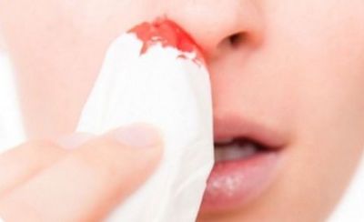 Что делать и как остановить кровь из носа