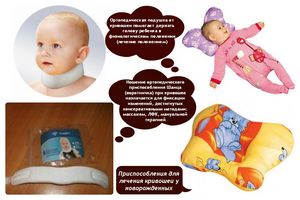 Диагноз «кривошея у новорожденного»: признаки, причины. что делать, если у новорожденного кривошея: лечение, процедуры