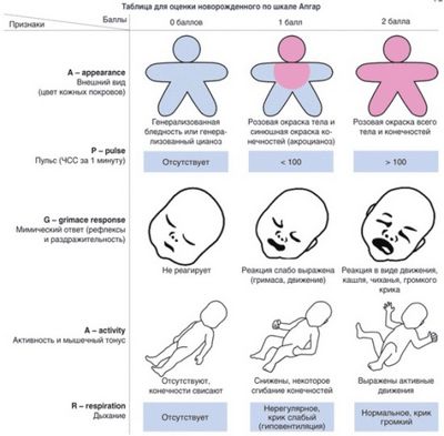Шкала апгар – как проводится оценка новорождённых? как влияет оценка по шкале апгар на будущее здоровье ребёнка